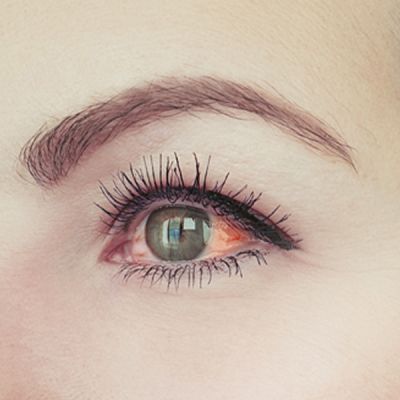 day-hospital-borgo-wuhrer-cataratta-patologie